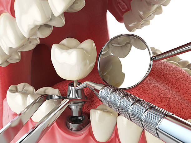 Best Emergency TMJ Treatment in Needles, CA